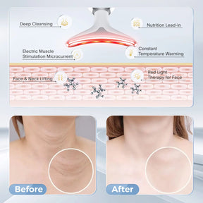 7-Color LED Facial & Neck Massager for Skin Tightening