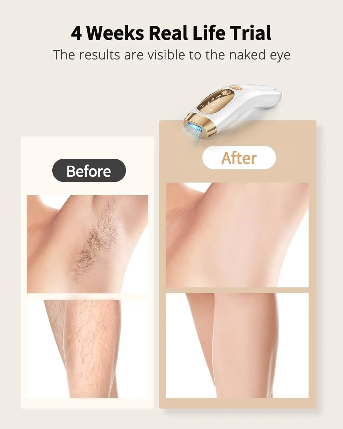 IPL Hair Removal Laser with 9 Gears & Ice-Cooling for Men & Women